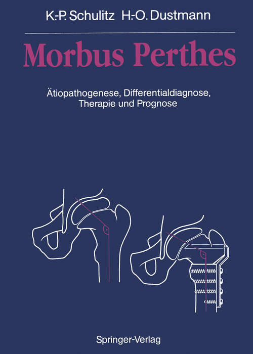 Book cover of Morbus Perthes: Ätiopathogenese, Differentialdiagnose, Therapie und Prognose (1991)