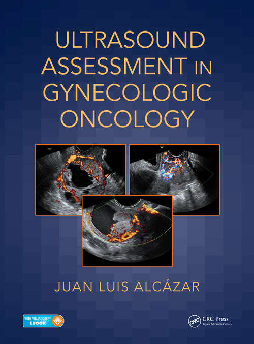 Book cover of Ultrasound Assessment in Gynecologic Oncology