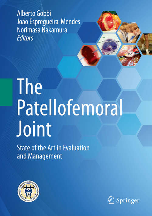 Book cover of The Patellofemoral Joint: State of the Art in Evaluation and Management (2014)