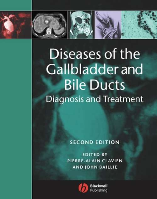 Book cover of Diseases of the Gallbladder and Bile Ducts: Diagnosis and Treatment (2)