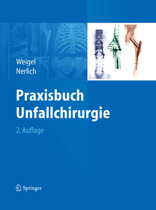 Book cover of Praxisbuch Unfallchirurgie (2. Aufl. 2011)
