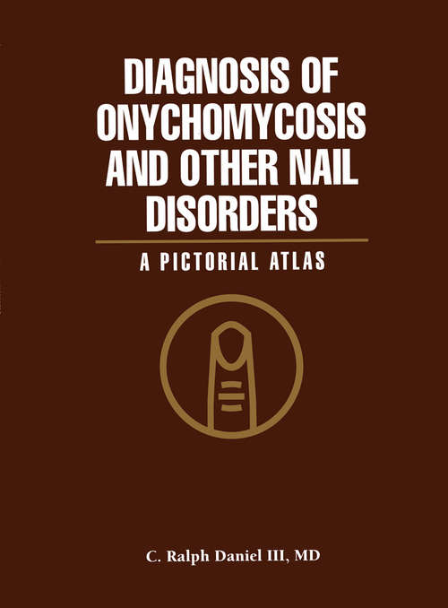 Book cover of Diagnosis of Onychomycosis and Other Nail Disorders: A Pictorial Atlas (1996)