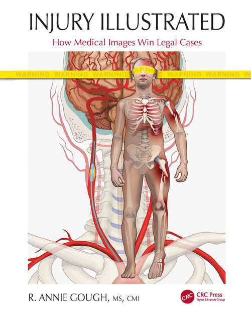 Book cover of Injury Illustrated: How Medical Images Win Legal Cases