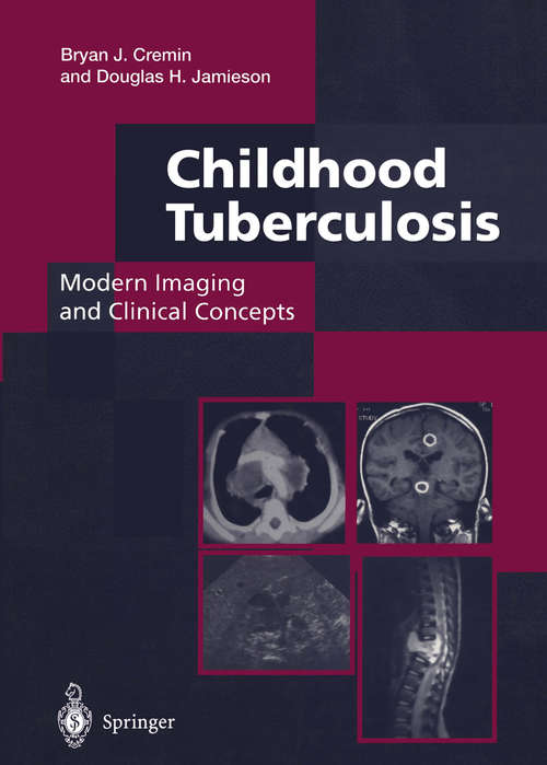 Book cover of Childhood Tuberculosis: Modern Imaging and Clinical Concepts: Modern Imaging And Clinical Concepts (1995)