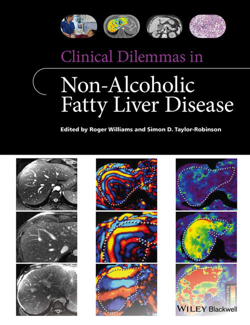 Book cover of Clinical Dilemmas in Non-Alcoholic Fatty Liver Disease (Clinical Dilemmas (UK))