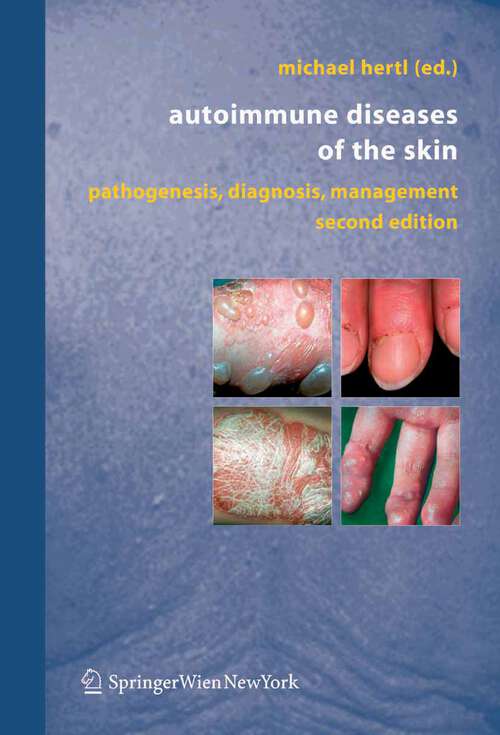 Book cover of Autoimmune Diseases of the Skin: Pathogenesis, Diagnosis, Management (2nd ed. 2005)