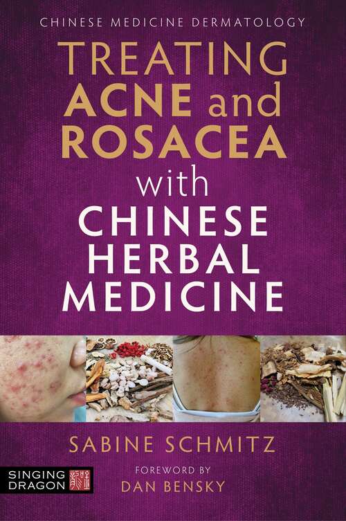 Book cover of Treating Acne and Rosacea with Chinese Herbal Medicine