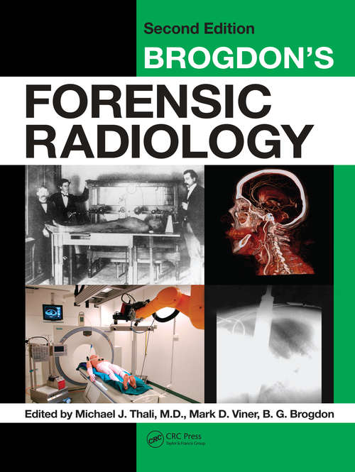 Book cover of Brogdon's Forensic Radiology (2)