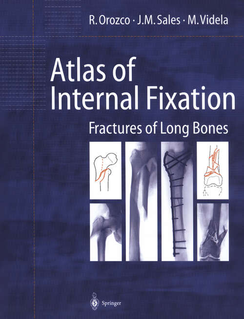 Book cover of Atlas of Internal Fixation: Fractures of Long Bones (2000)