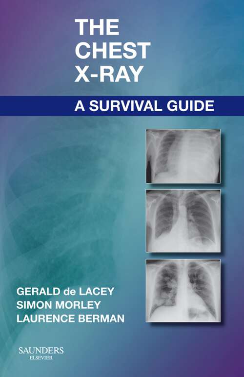 Book cover of The Chest X-Ray: A Survival Guide