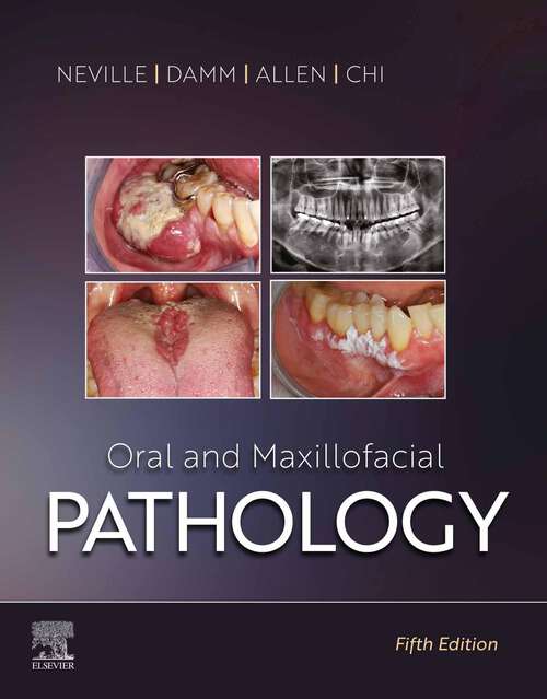 Book cover of Oral and Maxillofacial Pathology - E-Book (5)