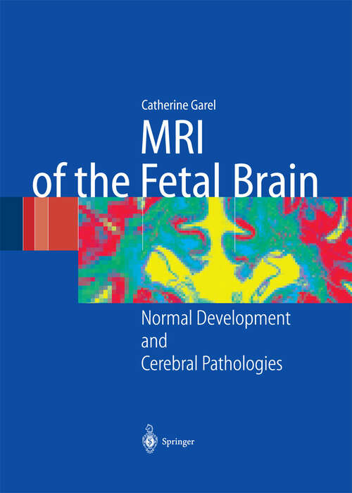 Book cover of MRI of the Fetal Brain: Normal Development and Cerebral Pathologies (2004)