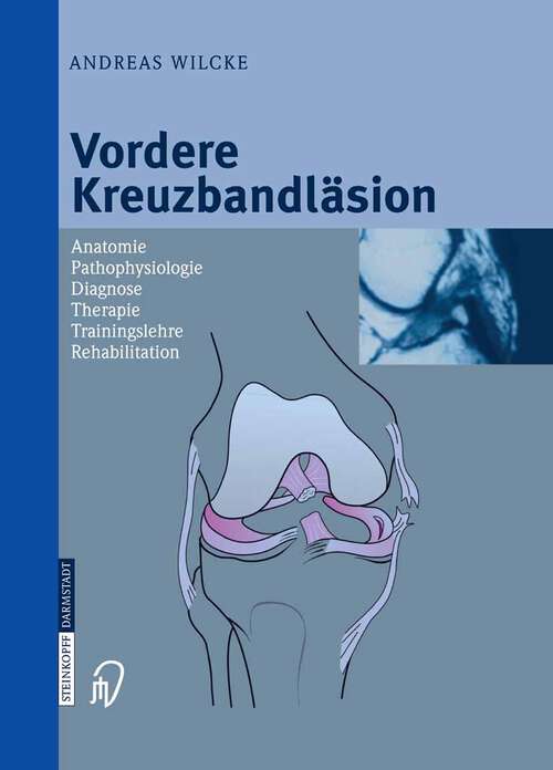 Book cover of Vordere Kreuzbandläsion: Anatomie Pathophysiologie Diagnose Therapie Trainingslehre Rehabilitation (2004)