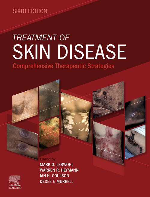 Book cover of Treatment of Skin Disease E-Book: Comprehensive Therapeutic Strategies (6)