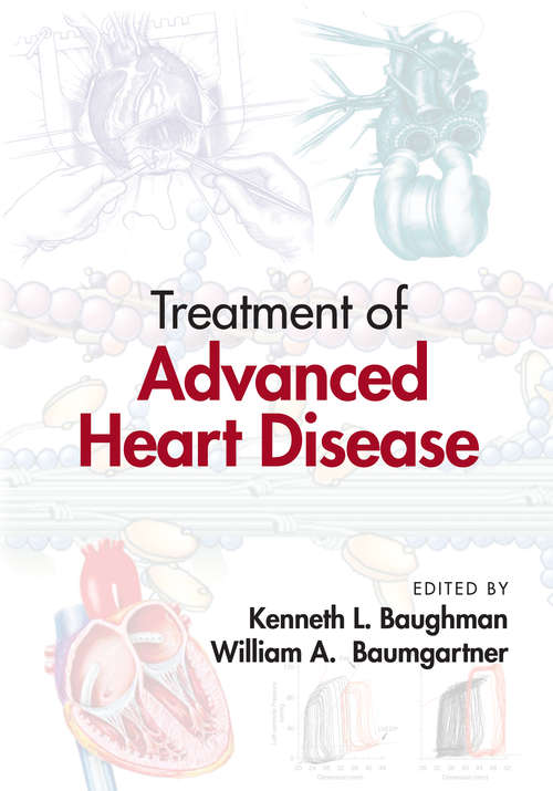 Book cover of Treatment of Advanced Heart Disease