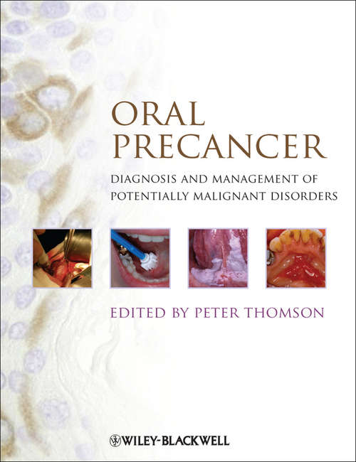Book cover of Oral Precancer: Diagnosis and Management of Potentially Malignant Disorders (2)
