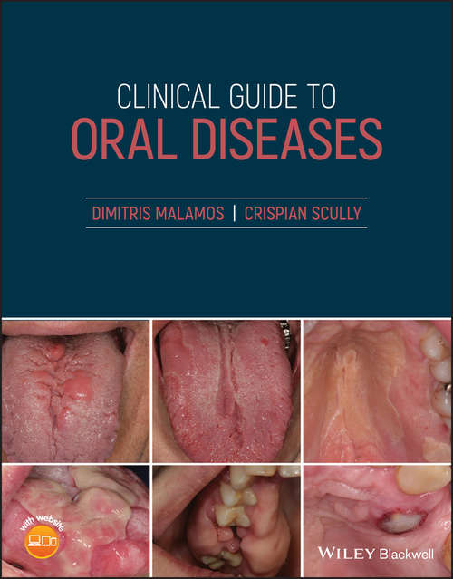 Book cover of Clinical Guide to Oral Diseases