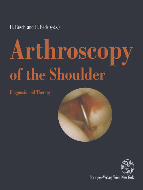 Book cover of Arthroscopy of the Shoulder: Diagnosis and Therapy (1992)