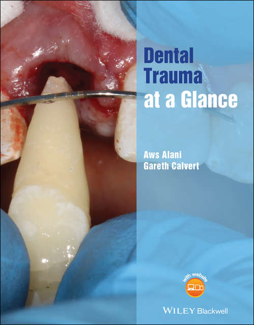 Book cover of Dental Trauma at a Glance (At a Glance (Dentistry))