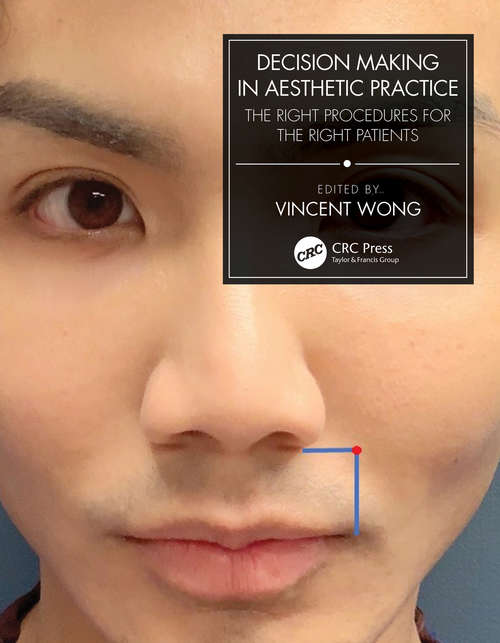 Book cover of Decision Making in Aesthetic Practice: The Right Procedures for the Right Patients