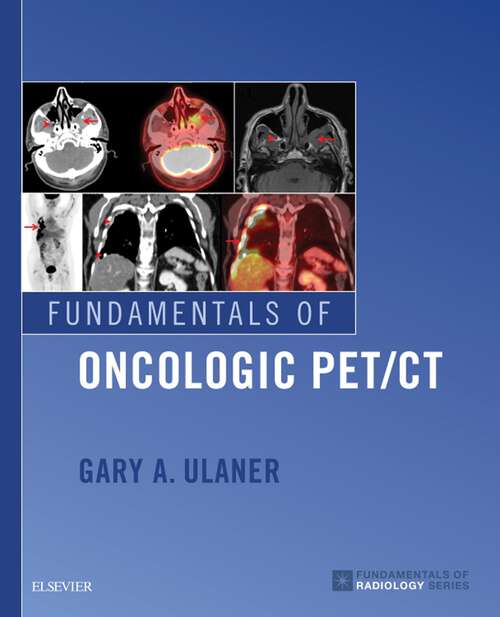 Book cover of Fundamentals of Oncologic PET/CT E-Book (Fundamentals of Radiology)