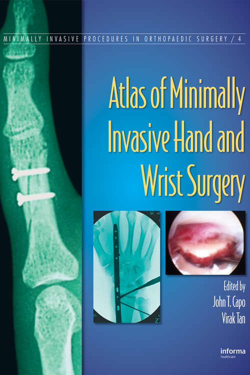 Book cover of Atlas of Minimally Invasive Hand and Wrist Surgery