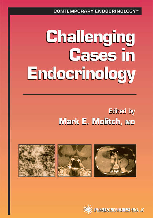 Book cover of Challenging Cases in Endocrinology (2002) (Contemporary Endocrinology)