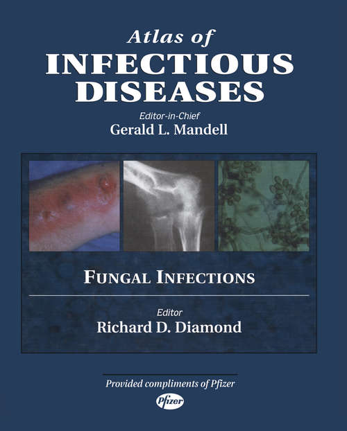 Book cover of Atlas of Infectious Diseases: Fungal Infections (2000)
