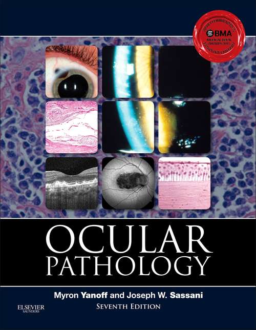 Book cover of Ocular Pathology E-Book: Expert Consult (7)