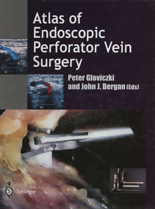 Book cover of Atlas of Endoscopic Perforator Vein Surgery (1998)