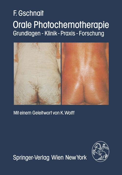 Book cover of Orale Photochemotherapie: Grundlagen — Klinik — Praxis — Forschung (1982)