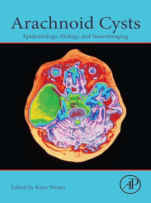 Book cover of Arachnoid Cysts: Epidemiology, Biology, and Neuroimaging