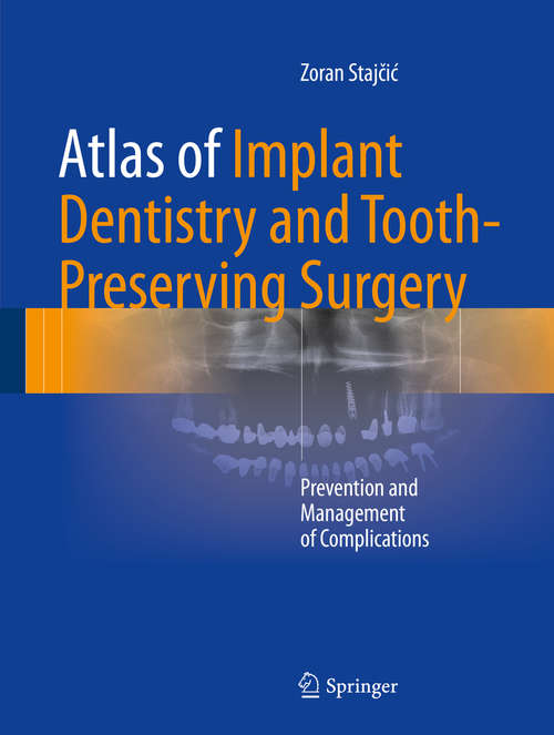 Book cover of Atlas of Implant Dentistry and Tooth-Preserving Surgery: Prevention and Management of Complications (1st ed. 2017)