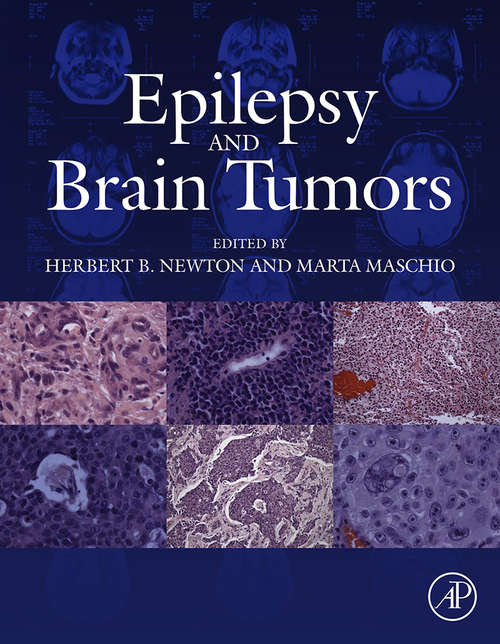 Book cover of Epilepsy and Brain Tumors