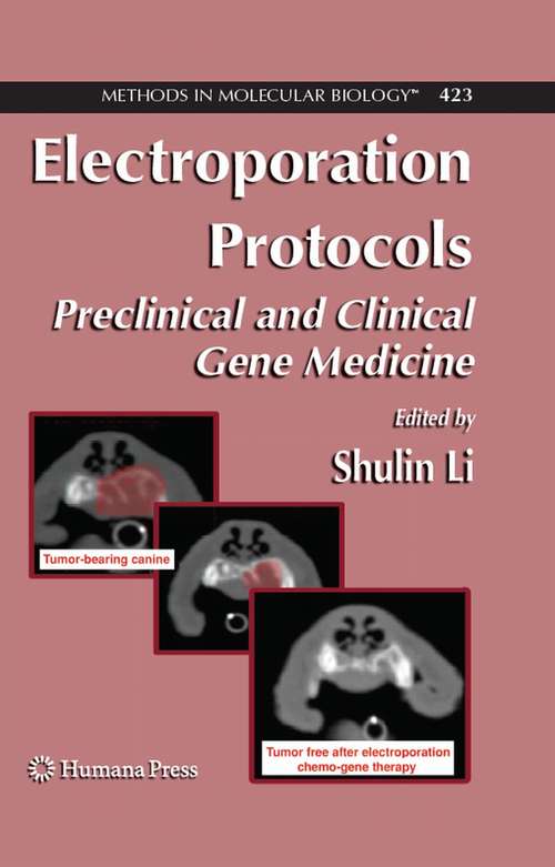 Book cover of Electroporation Protocols: Preclinical and Clinical Gene Medicine (2008) (Methods in Molecular Biology #423)