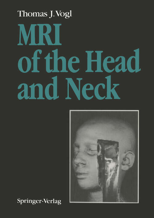 Book cover of MRI of the Head and Neck: Functional Anatomy — Clinical Findings — Pathology — Imaging (1992)