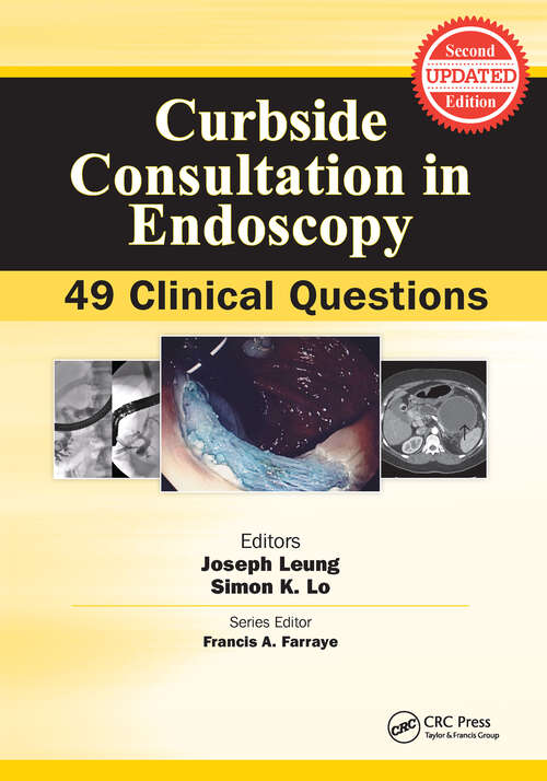 Book cover of Curbside Consultation in Endoscopy: 49 Clinical Questions (Curbside Consultation in Gastroenterology)