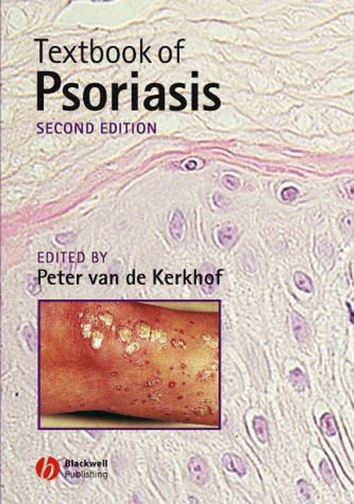 Book cover of Textbook of Psoriasis (2)