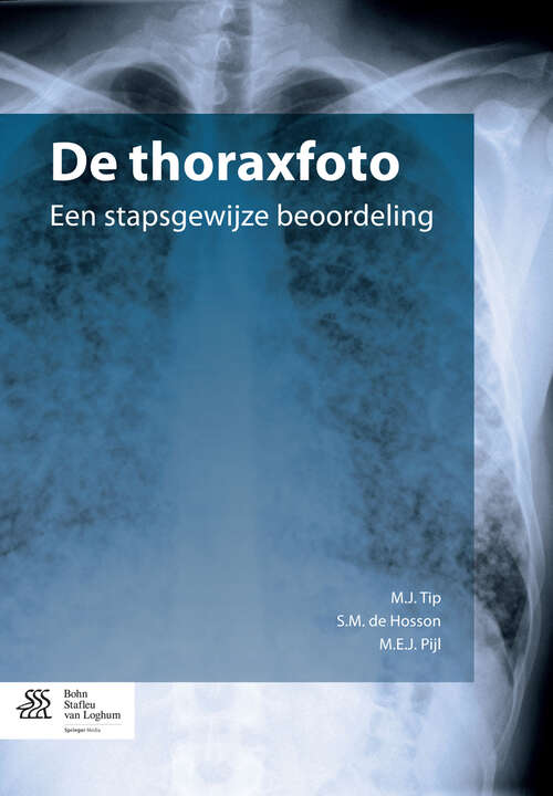 Book cover of De thoraxfoto: een stapsgewijze beoordeling (2012)