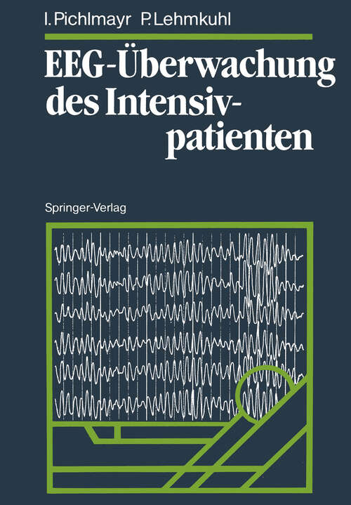 Book cover of EEG-Überwachung des Intensivpatienten (1988)