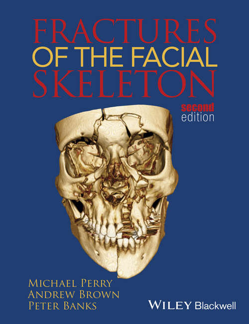 Book cover of Fractures of the Facial Skeleton (2)