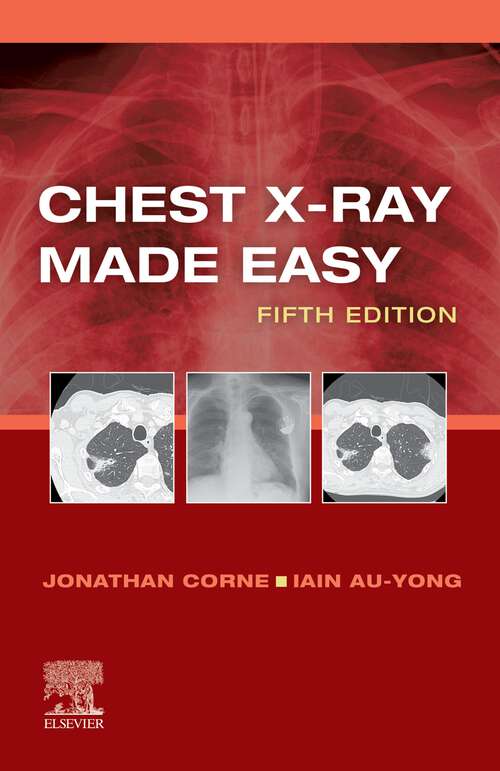 Book cover of Chest X-Ray Made Easy E-Book: Chest X-Ray Made Easy E-Book (5) (Made Easy)