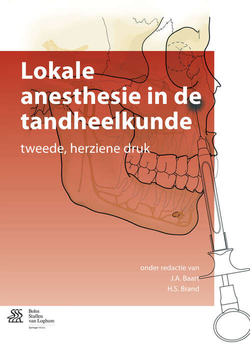 Book cover of Lokale anesthesie in de tandheelkunde (2nd ed. 2013)