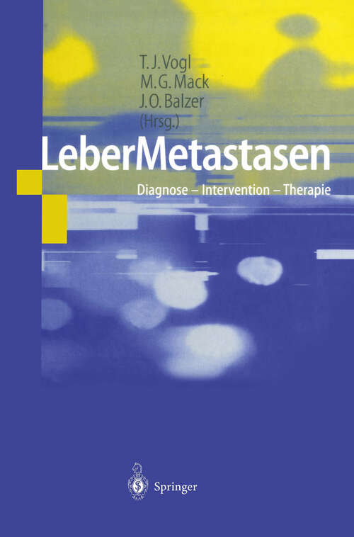 Book cover of LeberMetastasen: Diagnose — Intervention — Therapie (2002)