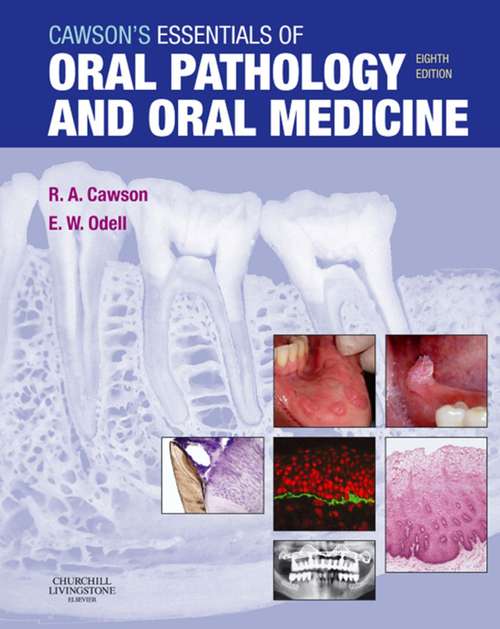 Book cover of Cawson's Essentials of Oral Pathology and Oral Medicine E-Book (7)