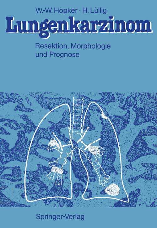 Book cover of Lungenkarzinom: Resektion, Morphologie und Prognose (1987)