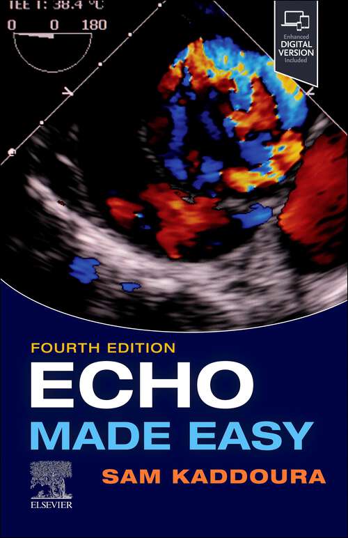 Book cover of Echo Made Easy , E-Book: Echo Made Easy , E-Book (Made Easy)