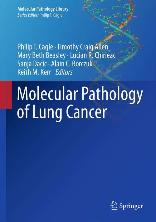 Book cover of Molecular Pathology of Lung Cancer (2012) (Molecular Pathology Library #6)