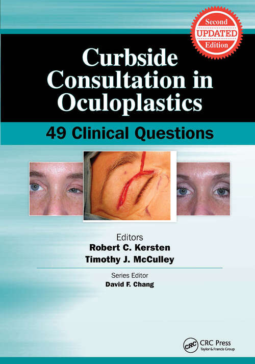 Book cover of Curbside Consultation in Oculoplastics: 49 Clinical Questions (Curbside Consultation in Ophthalmology)