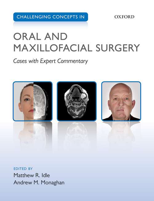 Book cover of Challenging Concepts in Oral and Maxillofacial Surgery: Cases with Expert Commentary (Challenging Cases)